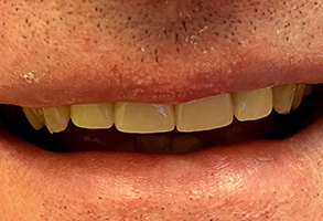 Denton Cosmetic Dentist