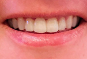 Cosmetic Dental Office near Denton