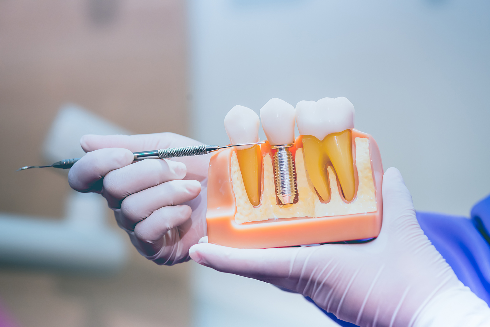 Denton Family Dental Clinic | TMJ Disorders, Dental Bridges and Extractions