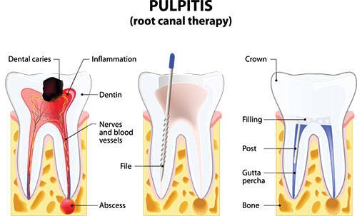 Dentist in Denton